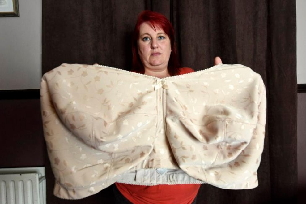 Moje grudi su me umalo ubile: Ispovijest Britanke čije poprsje teži 19 kilograma
